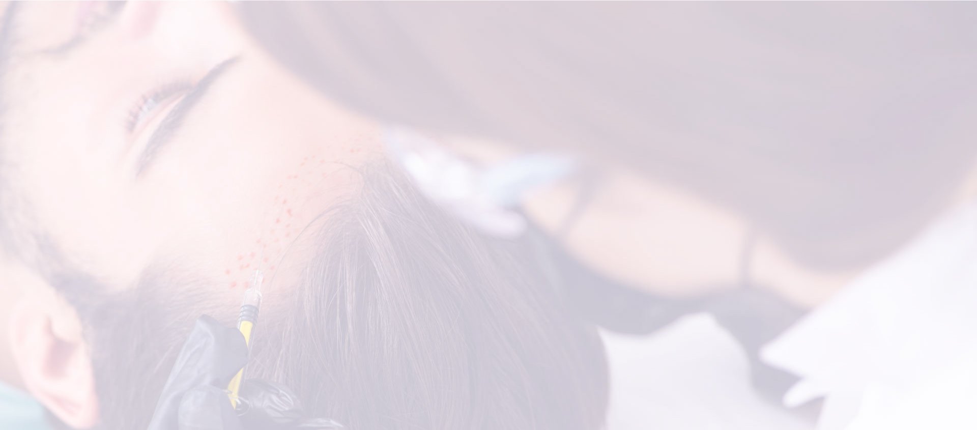 زراعه الشعر